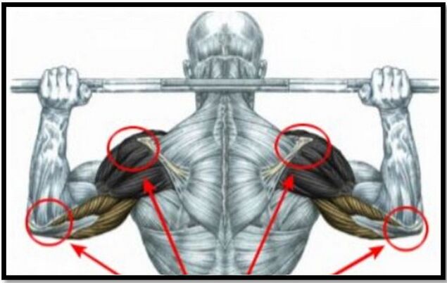 The load on the muscles of the shoulder and elbow is one of the causes of arthrosis of the shoulder joint