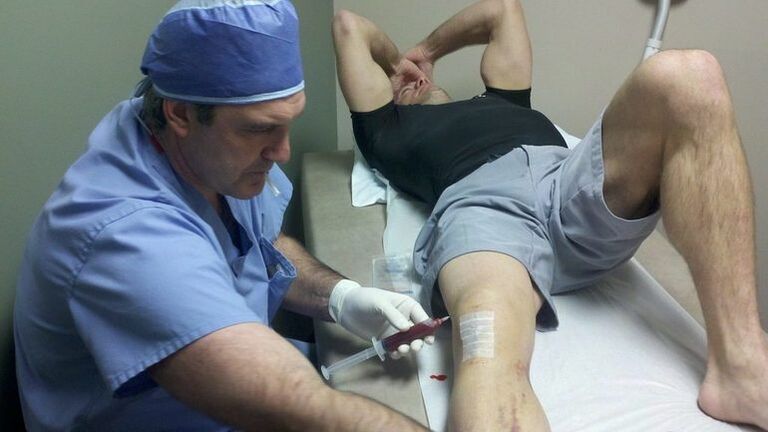 Treatment of the articulation of the knee joint