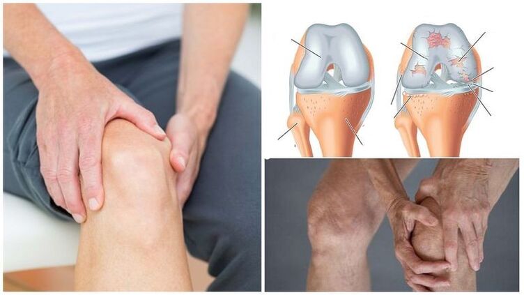 knee pain symptom of the arthritis of the knee joint